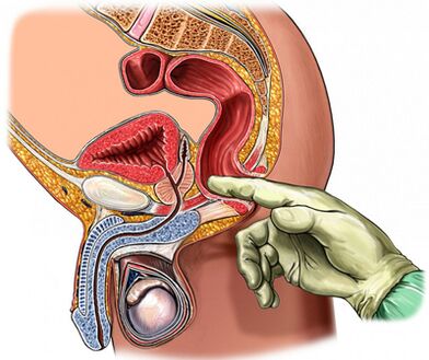 Esame digitale della prostata