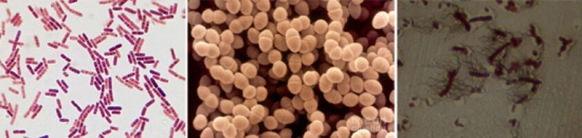 Escherichia coli, enterococchi fecali e Proteus sono le principali cause di prostatite batterica cronica